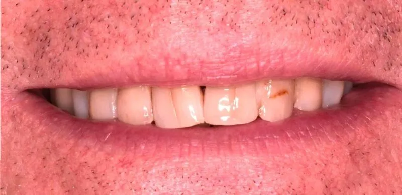 White teeth