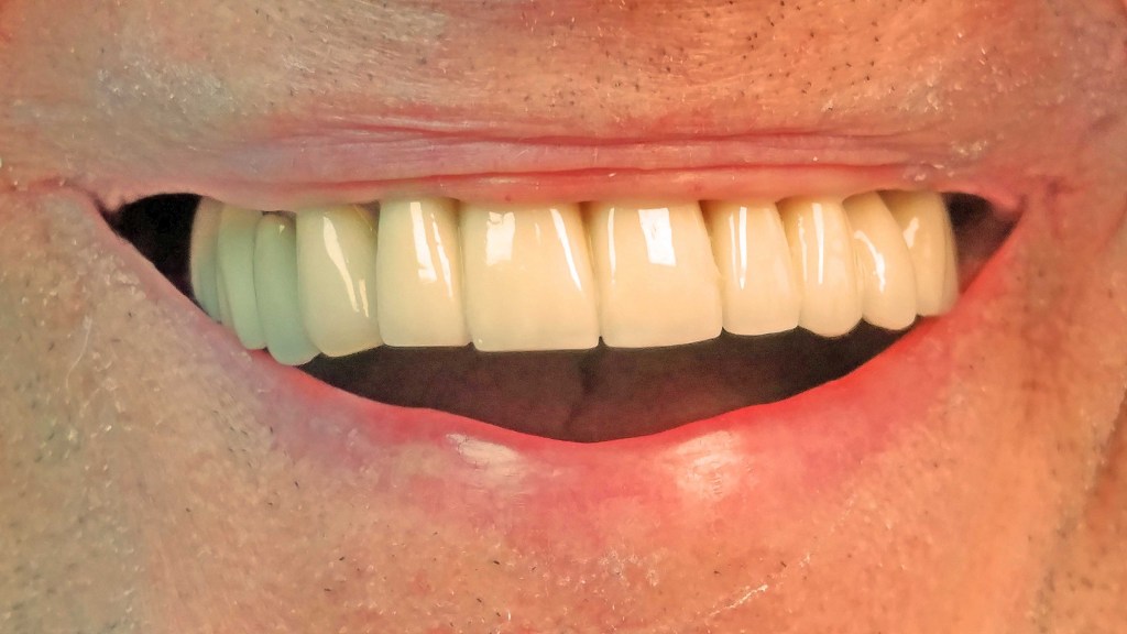 Straight, white teeth
