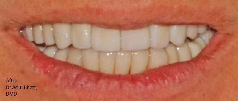 Straight, white teeth