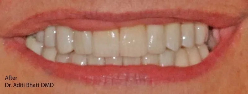 Straight, white teeth