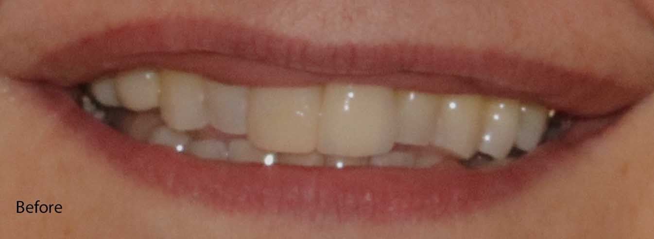 Straight, white teeth