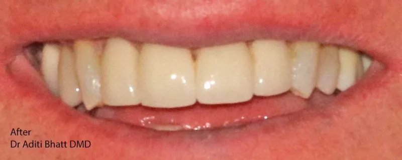 Straight, white teeth