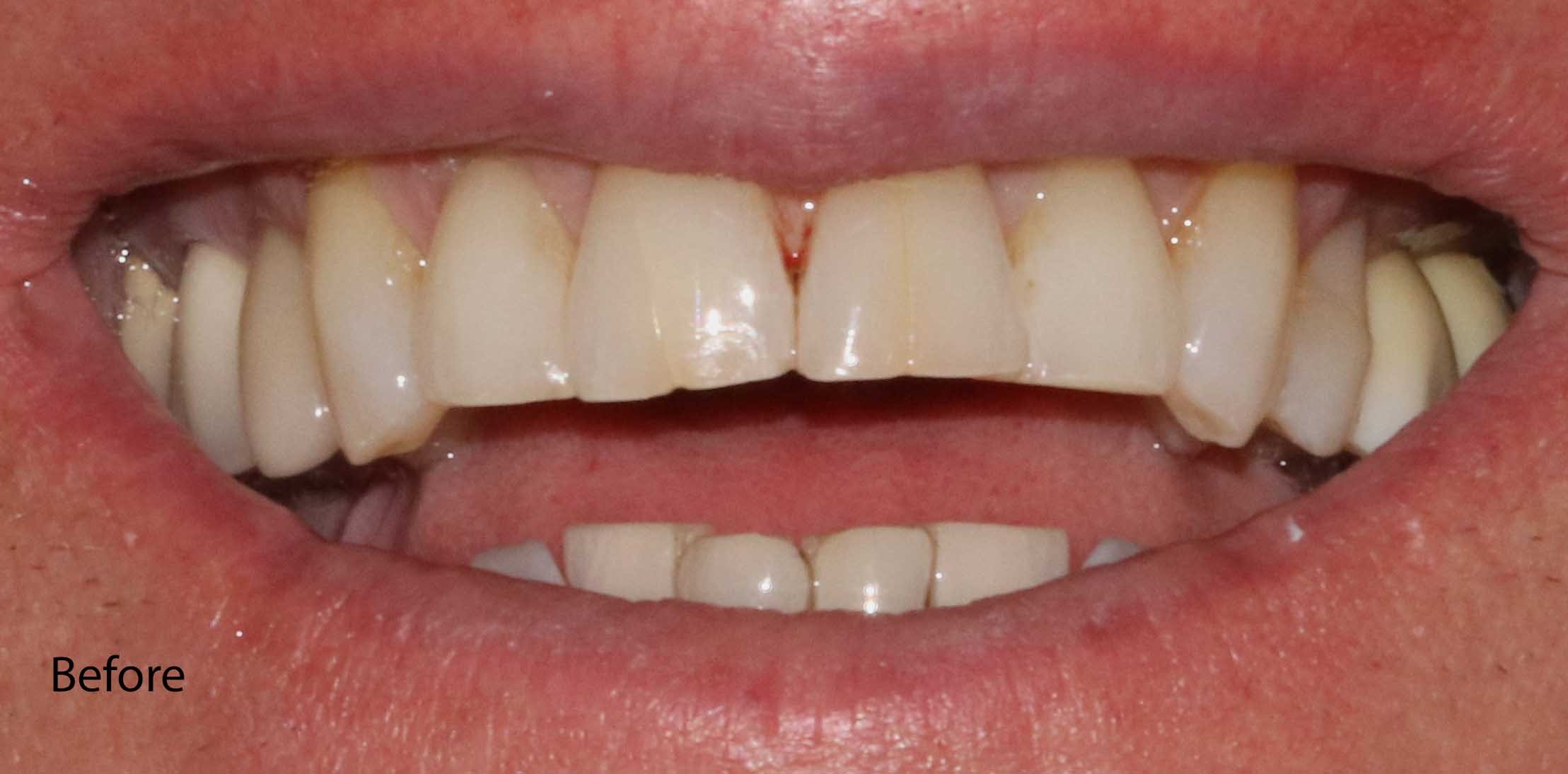 Straight, white teeth