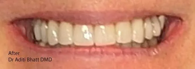 Straight, white teeth